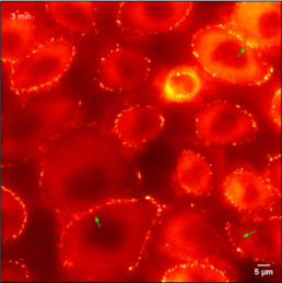 Project A1 Thumbnail