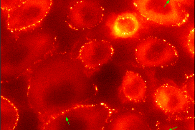 Project A1 Thumbnail