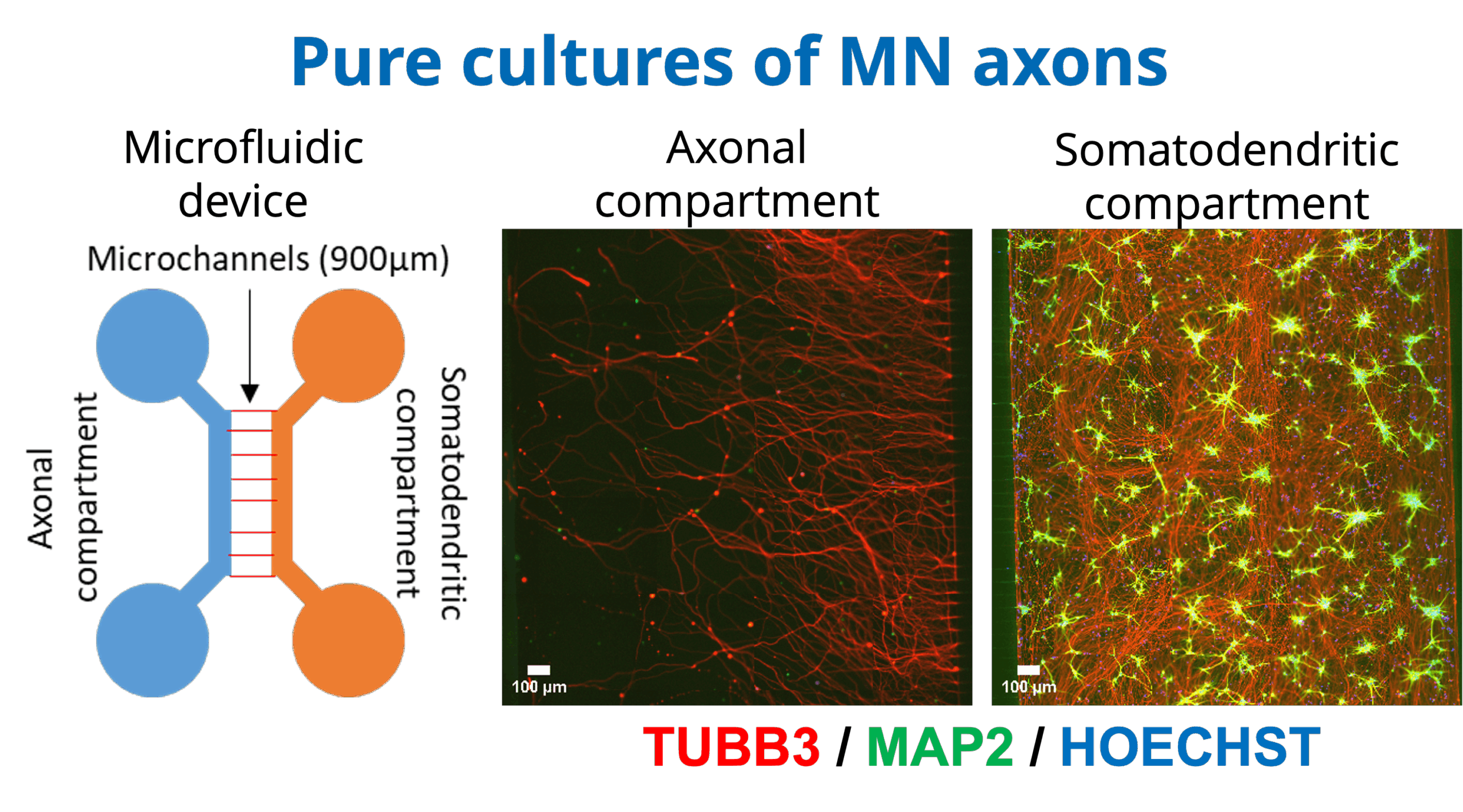 B2 Pure cultures of MN Axons