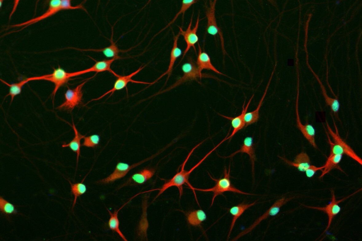 B2-Characterizing the role of RNP granules in ALS