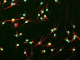 B2-Characterizing the role of RNP granules in ALS